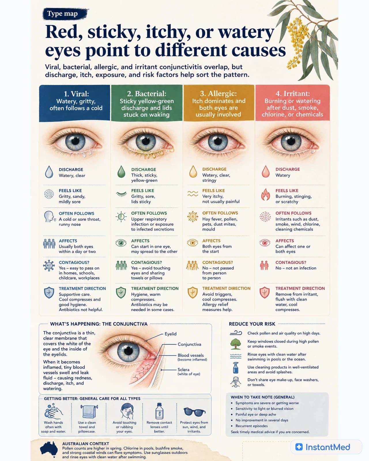 Viral, bacterial, allergic, and irritant conjunctivitis can look similar, but discharge, itch, exposure, and red flags help separate the causes.