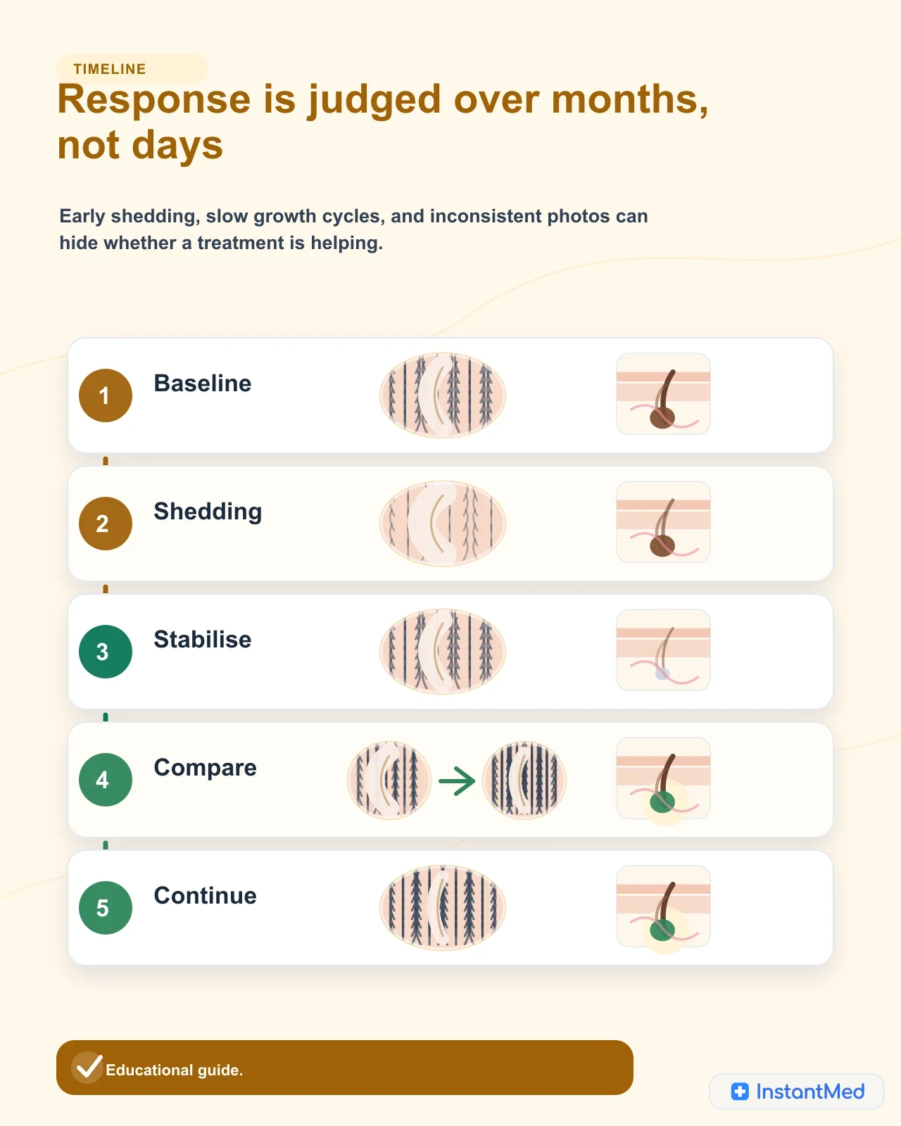 Response is judged over months, not days: Early shedding, slow growth cycles, and inconsistent photos can hide whether a treatment is helping.